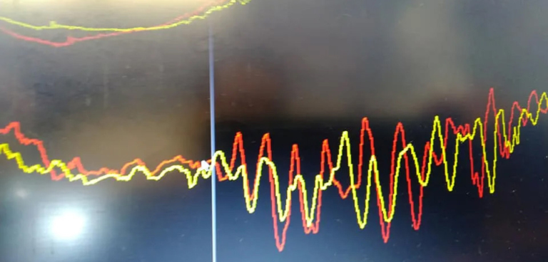 アエラ オーバーサスペンション|バイク界に革命を起こす新技術「オーバーサスペンション」【走行安定性が格段に向上】